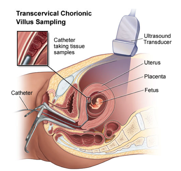 placental villi